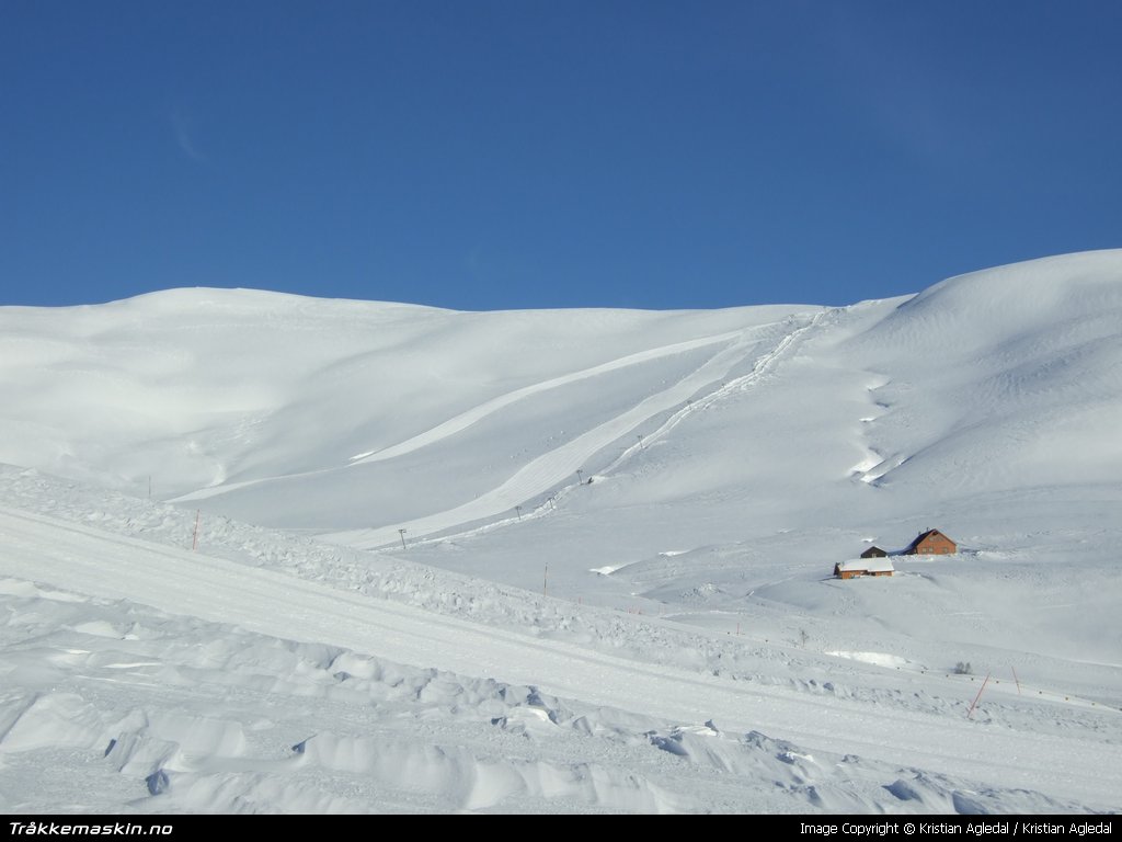 TRYKK FOR � G� TILBAKE TIL INFOVISNING